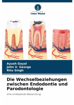 Die Wechselbeziehungen zwischen Endodontie und Parodontologie