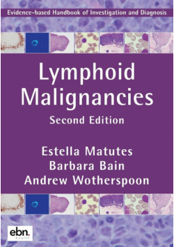 Lymphoid Malignancies