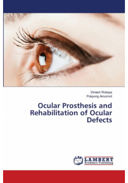 Ocular Prosthesis and Rehabilitation of Ocular Defects