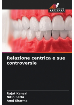 Relazione centrica e sue controversie