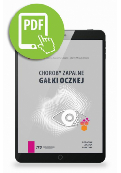 Choroby zapalne gałki ocznej - poradnik lekarza praktyka