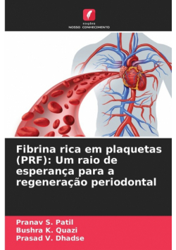 Fibrina rica em plaquetas (PRF)