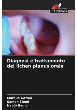 Diagnosi e trattamento del lichen planus orale