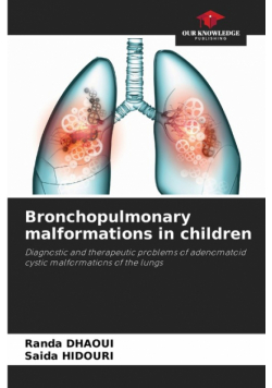 Bronchopulmonary malformations in children