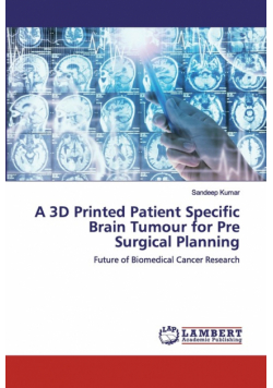 A 3D Printed Patient Specific Brain Tumour for Pre Surgical Planning