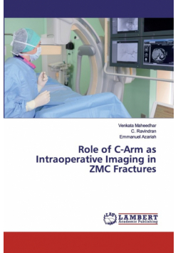 Role of C-Arm as Intraoperative Imaging in ZMC Fractures