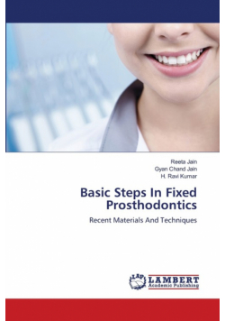 Basic Steps In Fixed Prosthodontics