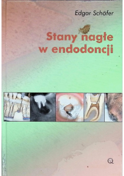 Stany nagłe w endodoncji