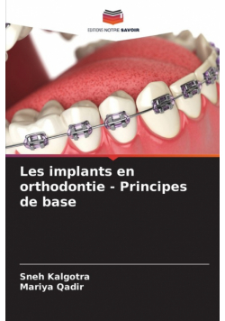 Les implants en orthodontie - Principes de base