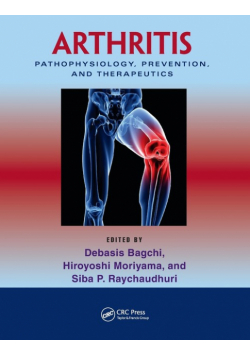 Arthritis
