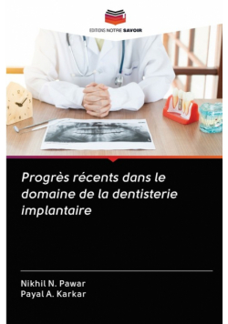 Progrès récents dans le domaine de la dentisterie implantaire