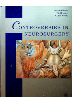 Controversies in neurosurgery