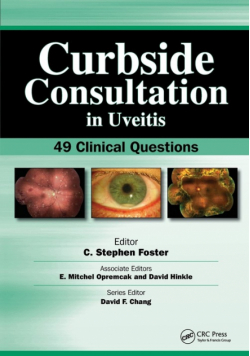 Curbside Consultation in Uveitis