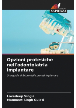 Opzioni protesiche nell'odontoiatria implantare