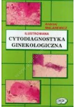 Cytodiagnostyka ginekologiczna