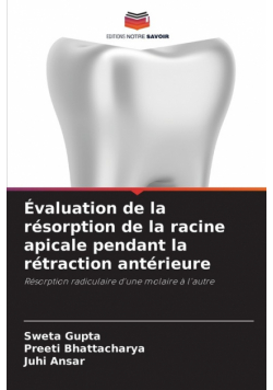 Évaluation de la résorption de la racine apicale pendant la rétraction antérieure