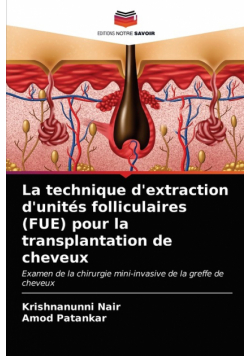 La technique d'extraction d'unités folliculaires (FUE) pour la transplantation de cheveux