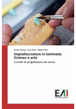 Impiallacciature in laminato