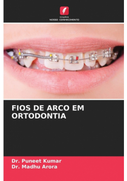Fios De Arco Em Ortodontia