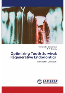 Optimizing Tooth Survival