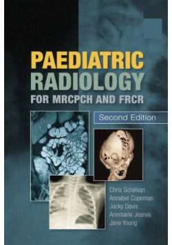 Paediatric Radiology for MRCPCH and FRCR, Second Edition