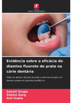 Evidência sobre a eficácia do diamino fluoreto de prata na cárie dentária