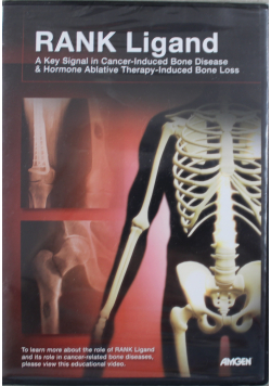 Rank Ligand a key signal in cancer induced bone disease CD