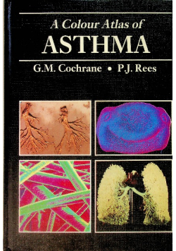 A Colour Atlas of Asthma