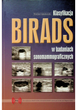 Birads w badaniach sonomammograficznych