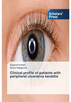 Clinical profile of patients with peripheral ulcerative keratitis