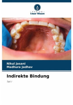 Indirekte Bindung