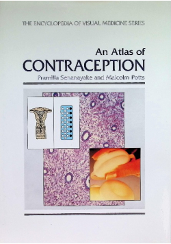 An Atlas of Contraception