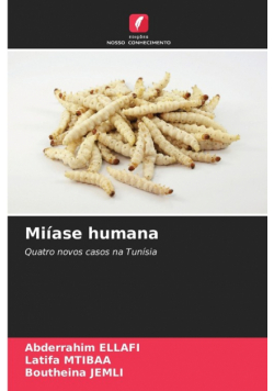 Miíase humana