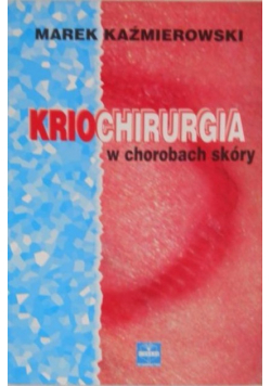 Kriochirurgia w chorobach skóry