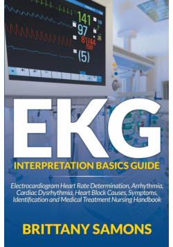 EKG Interpretation Basics Guide