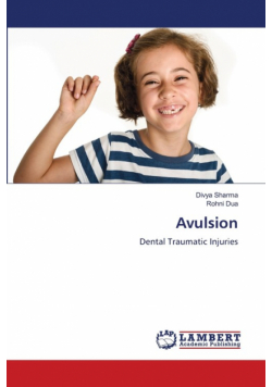 Avulsion