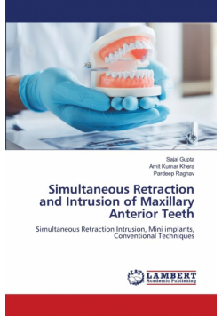 Simultaneous Retraction and Intrusion of Maxillary Anterior Teeth