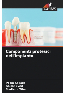 Componenti protesici dell'impianto