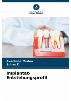 Implantat-Entstehungsprofil