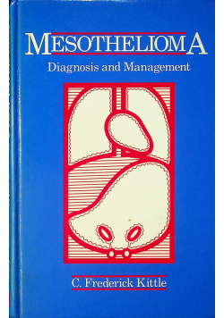 Mesothelioma diagnosis and Management