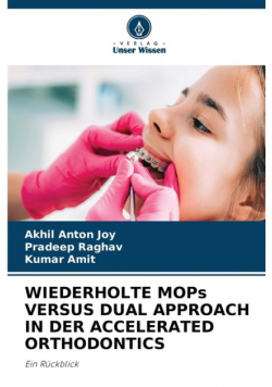 Wiederholte Mops Versus Dual Approach In Der Accelerated Orthodontics