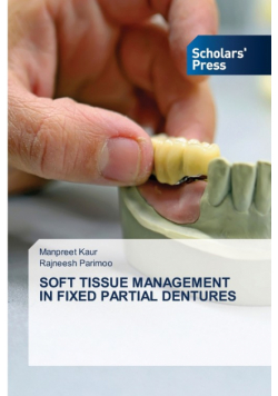 Soft Tissue Management In Fixed Partial Dentures