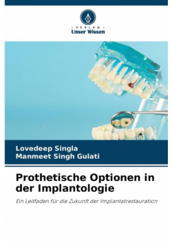 Prothetische Optionen in der Implantologie