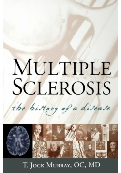 Multiple Sclerosis