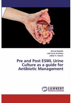Pre and Post ESWL Urine Culture as a guide for Antibiotic Management