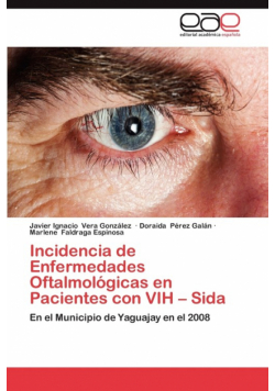 Incidencia de Enfermedades Oftalmologicas En Pacientes Con Vih - Sida
