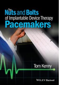 The Nuts and Bolts of Implantable Device Therapy -Pacemakers