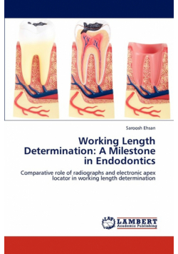 Working Length Determination