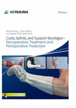 Casts, Splints, and Support Bandages