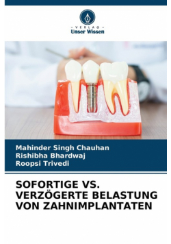 Sofortige Vs. Verzögerte Belastung Von Zahnimplantaten